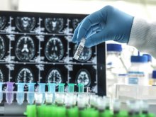 Game-changing Alzheimer’s Drugs Could Drive A Wave Of Investment Across ...